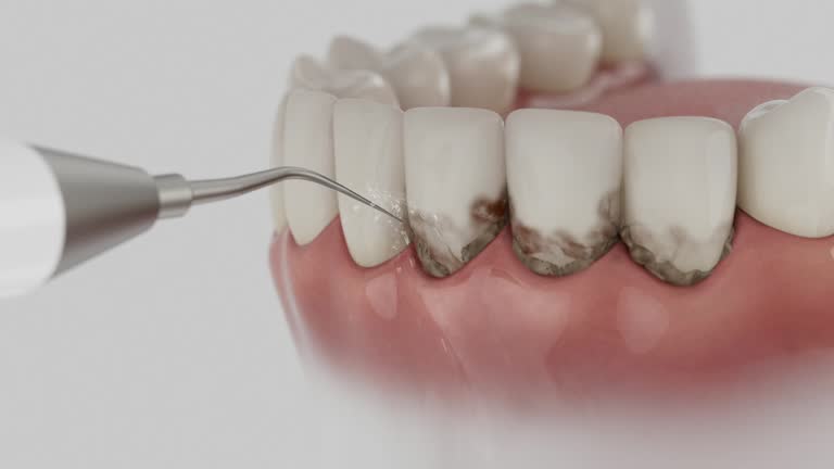 Reliable Dental contractor in Ladoga, IN by Dentist Open Now